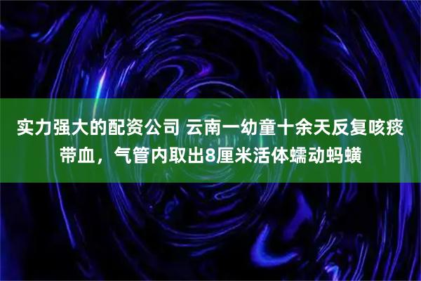 实力强大的配资公司 云南一幼童十余天反复咳痰带血，气管内取出8厘米活体蠕动蚂蟥